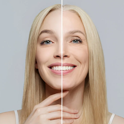 Anti Aging