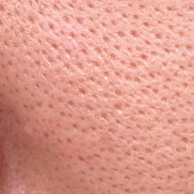 Open Pores